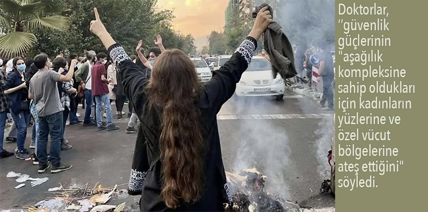 'İran polisi kadın protestocuların yüzlerine ve cinsel organlarına ateş ediyor'